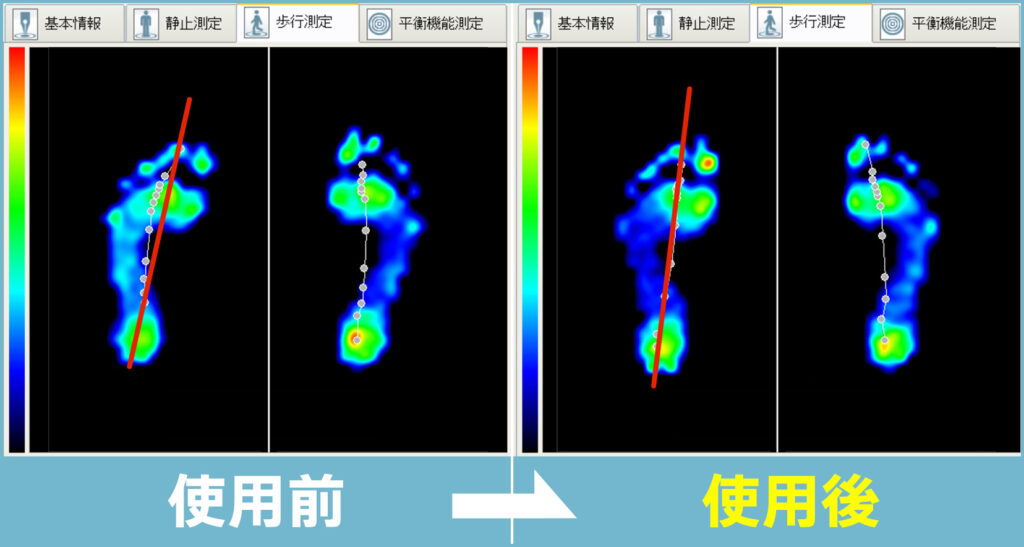 ゲートビューによる解析